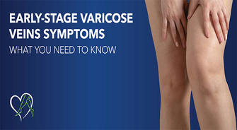 Attention! Leg Discomfort May Be an Early Sign of Varicose Veins