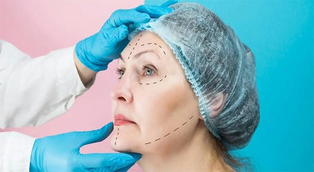 How Much Does Cosmetic Surgery Cost? A Simple Guide to Budgeting and Insurance